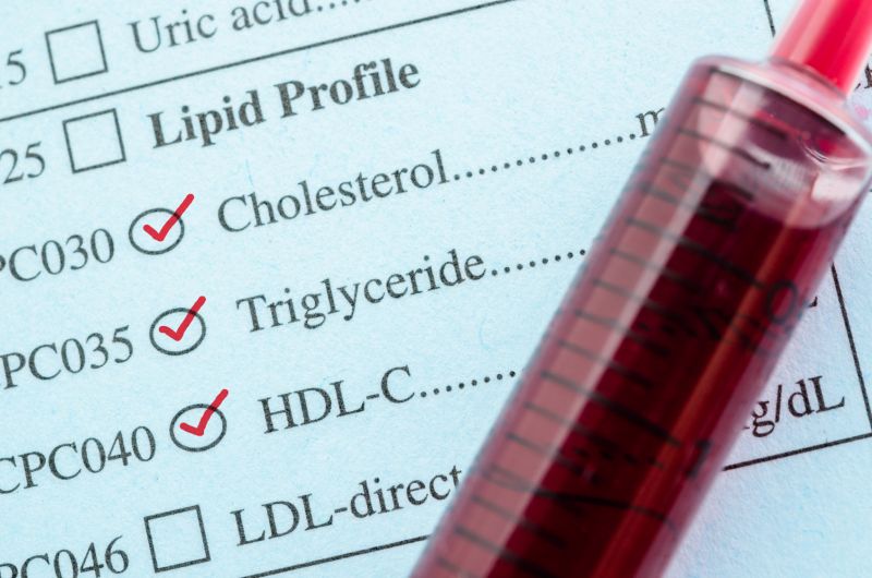 Paradoks: osoby starsze potrzebują wyższych wartości cholesterolu