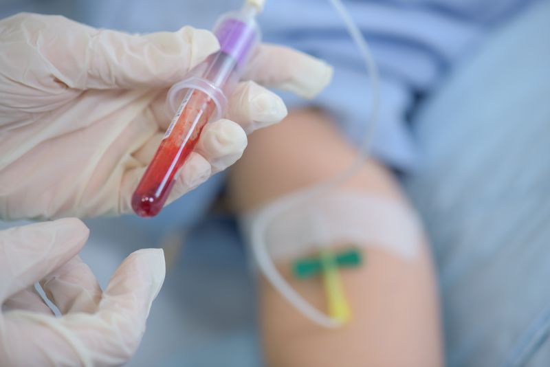 Z dziedzictwa ludowego do nowoczesnej medycyny – upuszczanie krwi