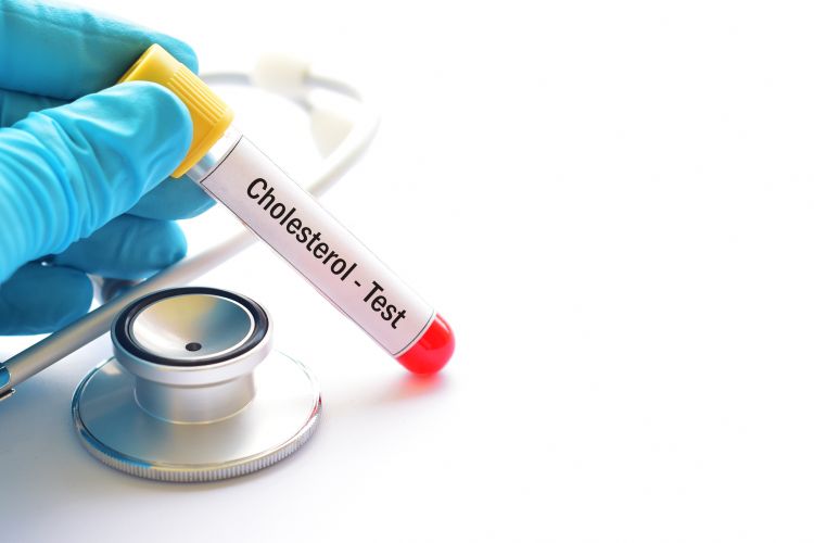 4 zaskakujące produkty, które podnoszą cholesterol!